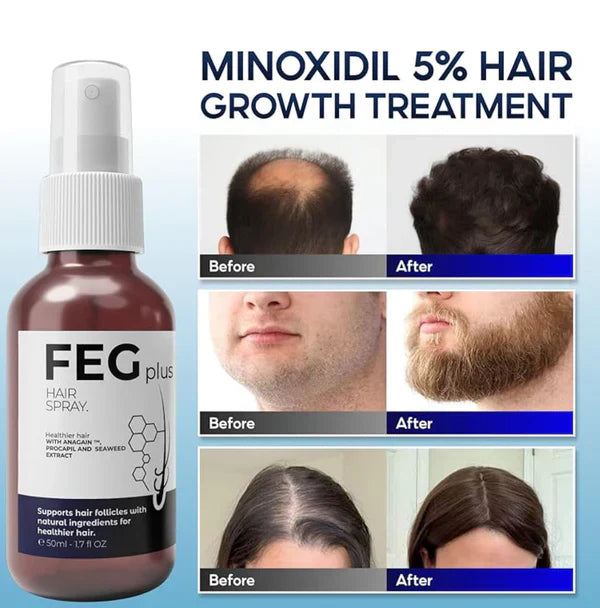 Premium Quality Feg Plus Hair Growth Spray
