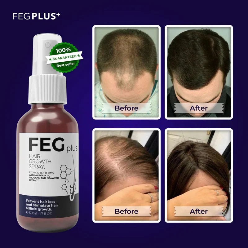 Premium Quality Feg Plus Hair Growth Spray