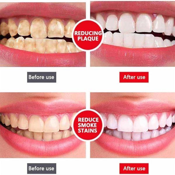 PREMIUM QUALITY SP4 Oral Care Probiotic Whitening paste