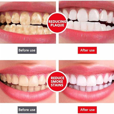 PREMIUM QUALITY SP4 Oral Care Probiotic Whitening paste